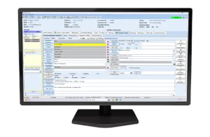 A monitor screen that displays the Procedure Information Organizer (PIO) screen within EndoVault®
