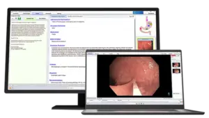 A monitor and laptop screen showing Argus AI gastro software with natural language processing and image capture respectively