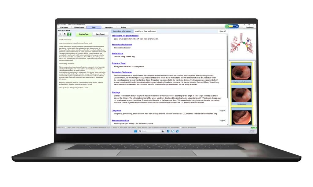 Argus® AI shown on a laptop with pulmonology documentation software with natural language processing