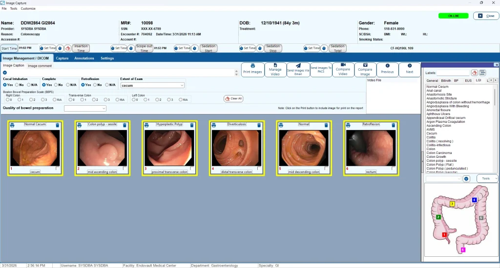 Medical reporting software interface by EndoSoft showing colonoscopy images and patient details.