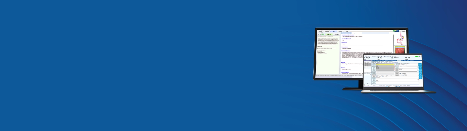 A banner comprised of a deep blue wave pattern behind a laptop screen and monitor showing EndoVault procedure documentation and Argus AI report writer software.