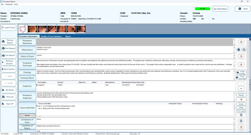 Medical reporting dashboard for EndoSoft displaying patient procedure details.