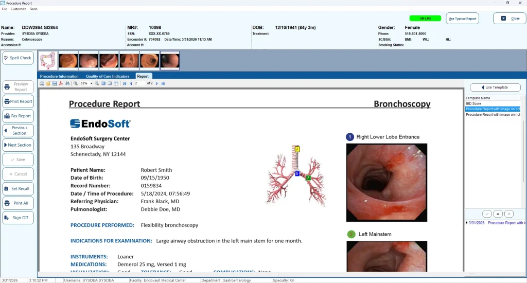 Medical procedure report screen for a bronchoscopy from EndoSoft.
