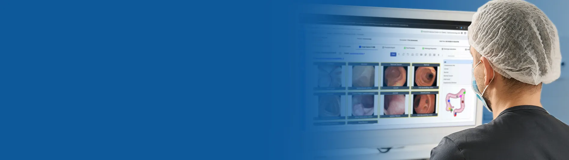EndoSoft Integrates Seamlessly with Epic Lumens for Endoscopy and Gastroenterology Image Capture