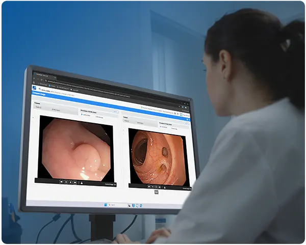 EndoSoft Gastroenterology and Endoscopy Image Comparison Feature for EndoVault Software, compatible with Epic Lumens