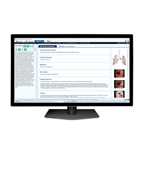 Argus Flexible Bronchoscopy 2026 on Computer